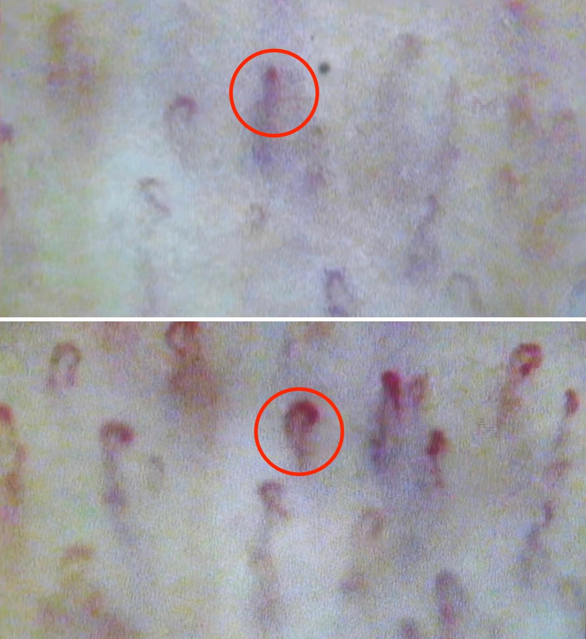 Penis Blood Vessels Penis Blood Vessels